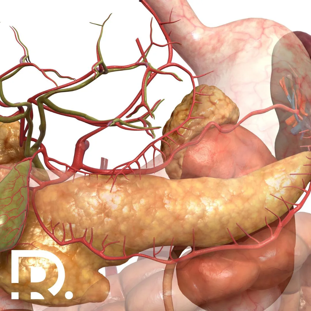 Cancerul pancreatic