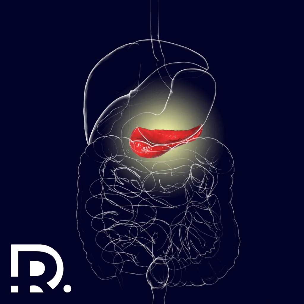 Cancerul pancreatic