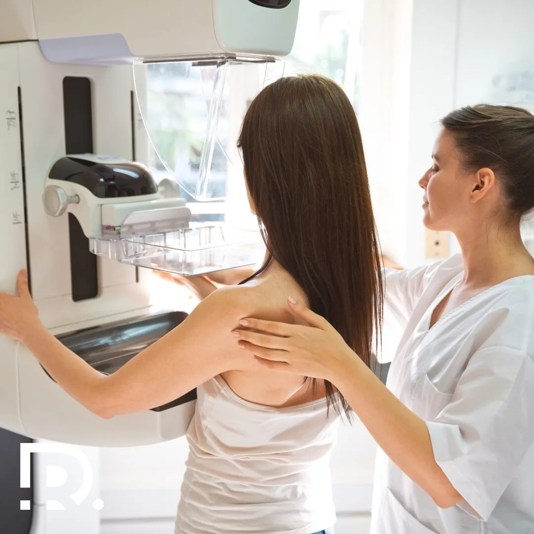 Prevenția cancerului mamar