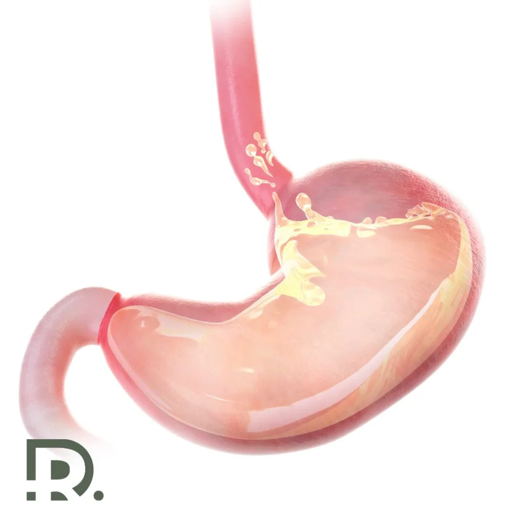 Rezecția gastrică laparoscopică
