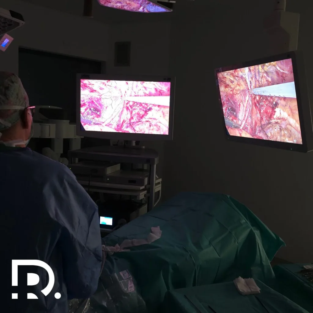 De ce hernia inghinală apare mai des la bărbați?