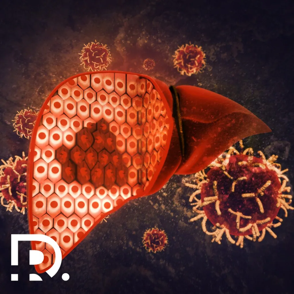 Cauzele cancerului hepatic