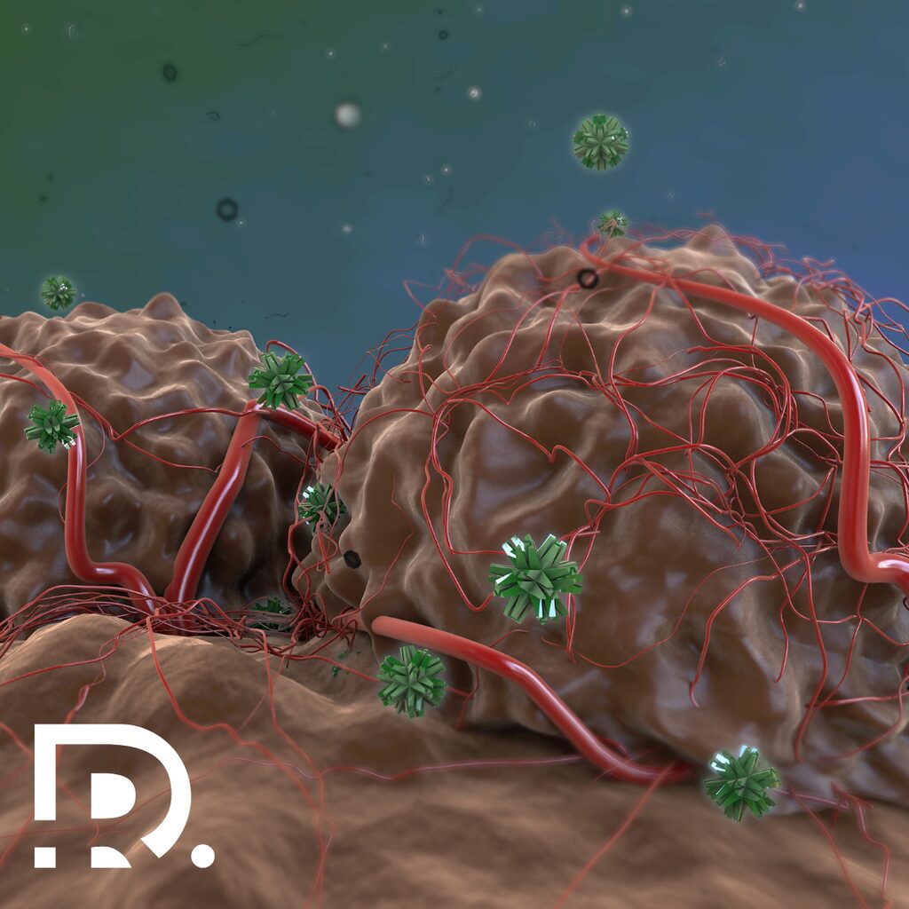 Recidiva cancerului după operație