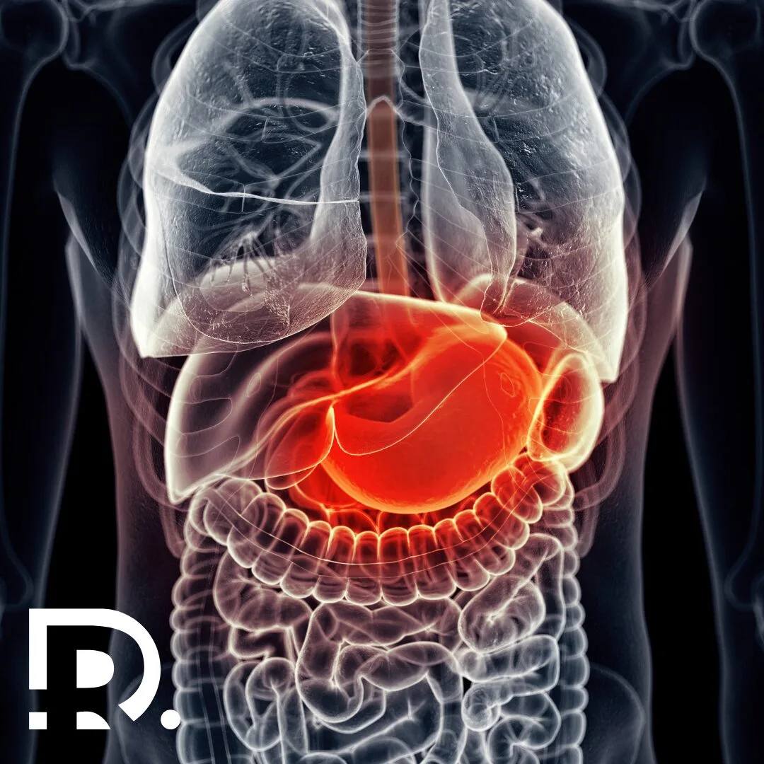 Inflamația cronică și cancerul gastrointestinal