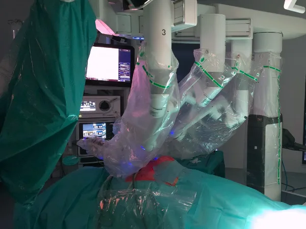 hernia parastomala abord robotic